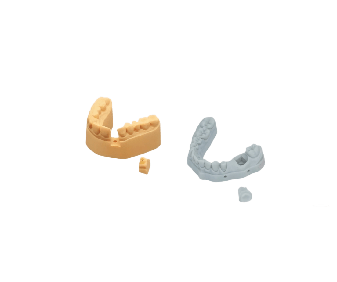 Implant Model