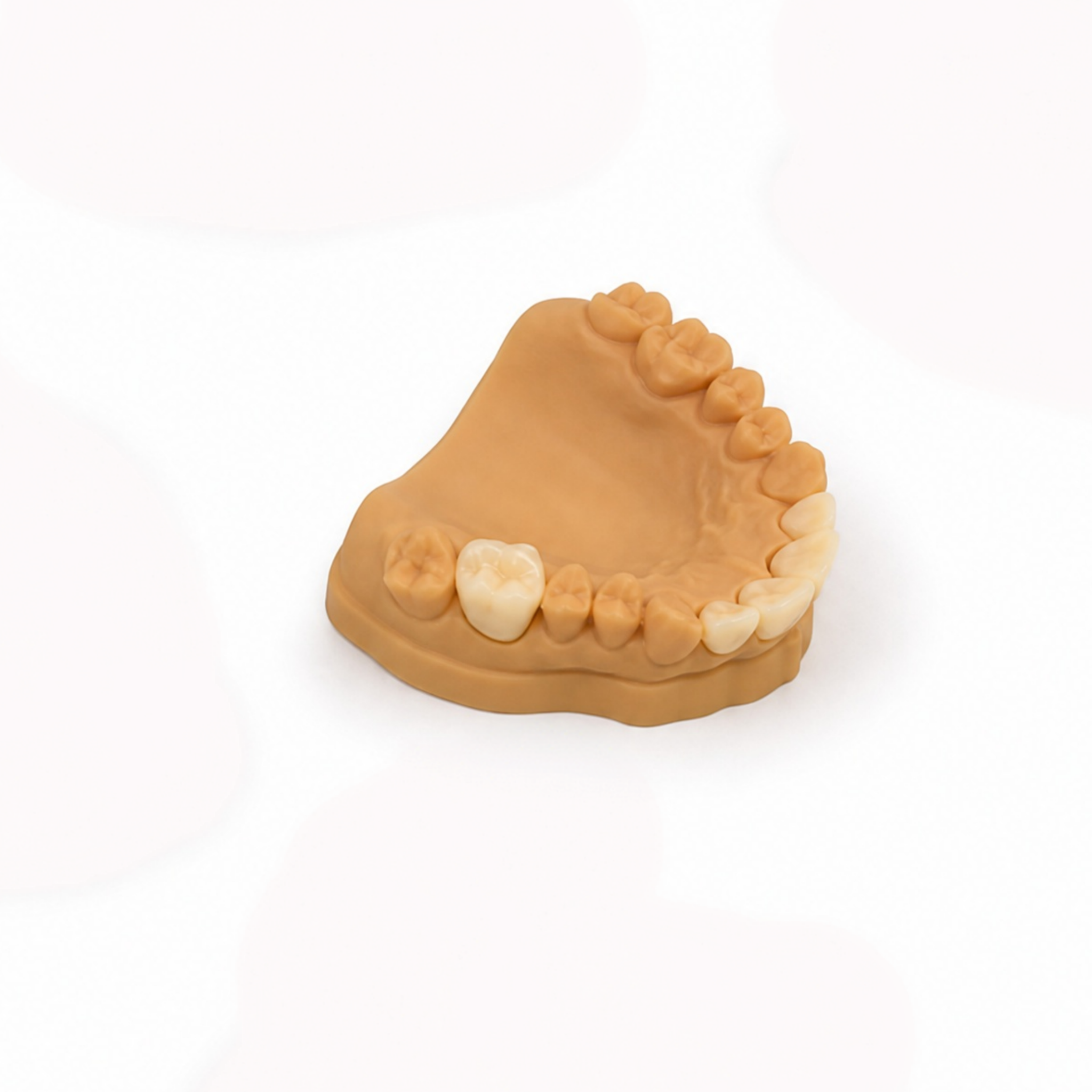 Temporary Crown & Bridge Restorations