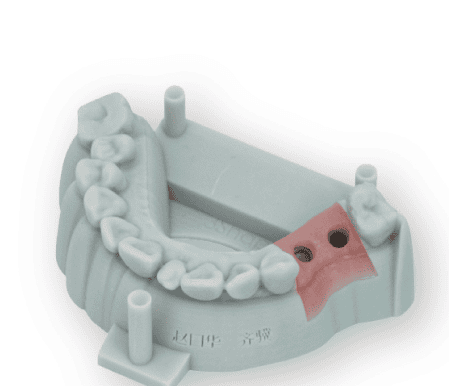 Restoration model printed on RP-200D