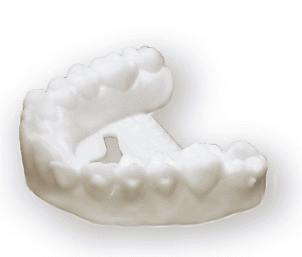 Orthodontic model printed on RP-200D