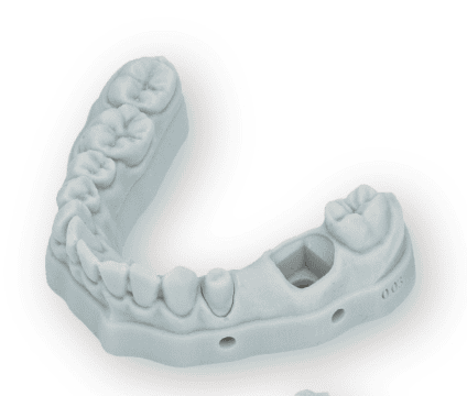 Implant model printed on RP-200D
